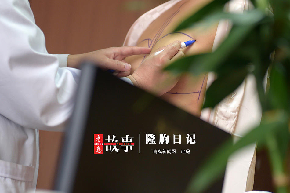 青岛90后模特瞒着爸爸做隆胸手术