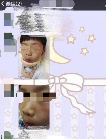 　　4月19日，有微博网友爆料南京一幼儿园老师让学生互殴……为此记者进行了调查。据查证，这是南京实验幼儿园下属的方圆绿茵园。网帖里说，孩子调皮被逮到了，方圆绿茵幼儿园的老师就采取了这样一种方式：让学生互殴，据说这样能发泄男孩旺盛的精力。记者随后联系上了几位家长。家长证实了这件事：“我回家看到孩子身体有点异常，我说你又打架了啊，他说不是他自己想打的，是老师组织他们打架的！”