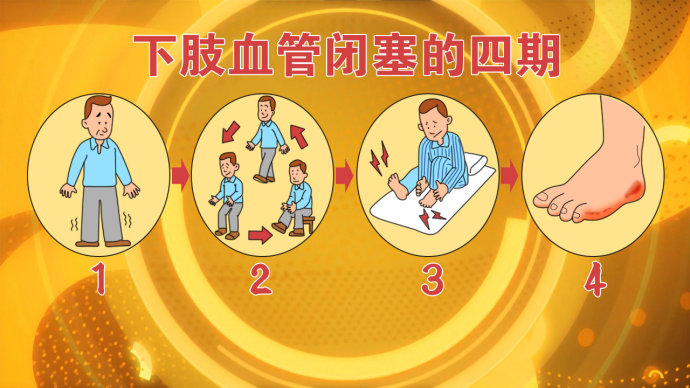 2016年5月3日播出《会“中风”的下肢》