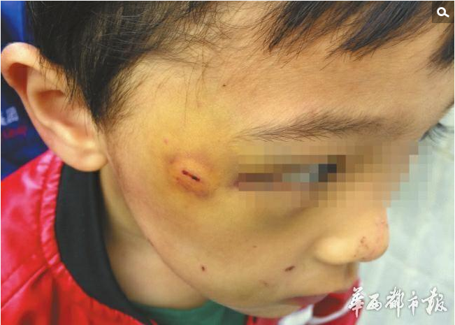 《反家庭暴力法》实施两个月。“黄荆棍下出好人”还是“暴力对娃娃的成长不好”？两种教育方式的交锋，在一位妈妈和邻居之间展开……在成都市武侯区鞋都南路附近一小区，洋洋一家租住在3楼，周薇薇在12楼。洋洋这次被打，是在5月4日晚上，因为不跟大人打招呼，就跑出去玩。