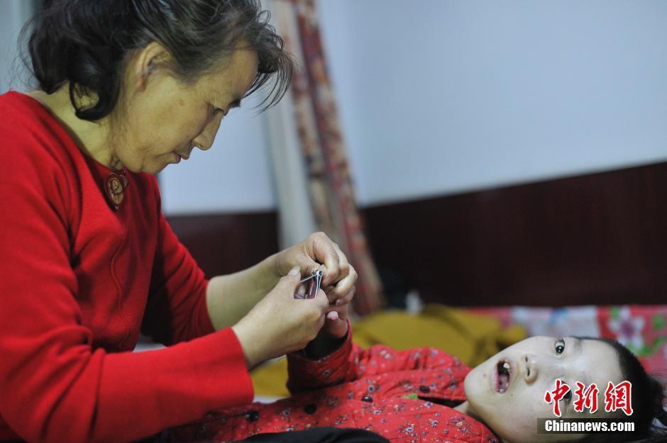 　　由于这个家庭靠一人打工维持，不仅毫无积蓄，就连所住的房子都是借居亲戚的。李焕梅被诊断出咽喉癌后，无力治疗的她选择了放弃，目前她的身体每况愈下，食道已经不能吞咽食物，只能吃流食。图为5月29日，李焕梅为脑瘫女儿赵丽坤剪指甲。