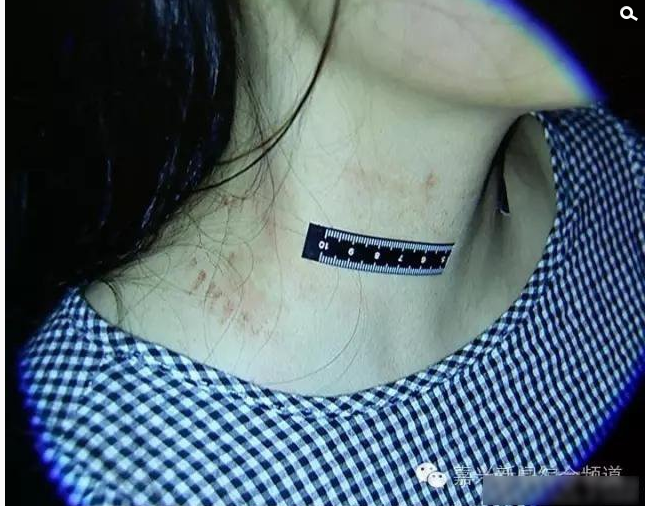 　　十几分钟后，陶某就接到了房东的电话，因为阿芬拼命的求救声惊动了房东。于是，房东报了警。接到报警后，警察马上赶到现场。