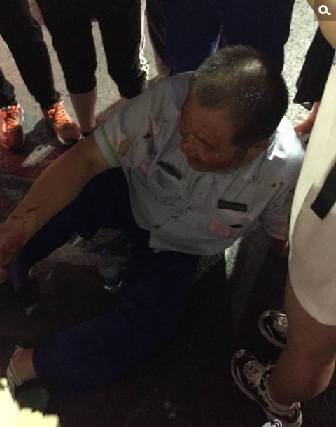 　　记者从北京公交公司通州分公司燕郊站了解到，被打司机初步诊断为鼻梁骨折，并伴随轻微脑震荡，已出院并前往公安机关做笔录。目前，公交公司也在配合警方调查。