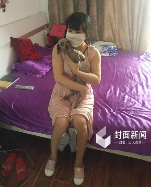 　　13年前，这位“中国整形第一人”在乳房注射了奥美定后，就成了“装在套子里的人”。“疼，疼死我了，我在手术台上踹，说不做了，但是不行，因为一边已经打了。”对于手术过程，红粉唯一的印象就是疼，“感觉就像往已经装满的容器内强行加东西，要撑爆了一样。”当约两个小时的注射手术做完后，顶着疼痛，当站在镜子前的那一刻，红粉就将所有的痛楚抛诸脑后了。“真的好看了，挺起来了，效果很明显。”这样立竿见影的效果，让红粉又先后两次走进了手术室，共计注射了约600ml的药品。红粉的小腿上，还安装着断骨增高的钢架，怀里的小狗，成了她唯一的玩伴。