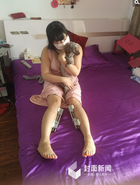 　　因为疼痛感日渐强烈，而且出现了明显的身体异常，红粉只能选择取出手术。“大概是在09年。也是在哈尔滨的一个医院做的，医生姓冉。”红粉说，手术的过程她已经记不清了，但是结果她还记得，那就是后面又连着做了7次取出手术，配上相关的修复手术，“光是取奥美定，相关的手术做了30多次，花了几十万。好几次，差点就死在手术台了。”