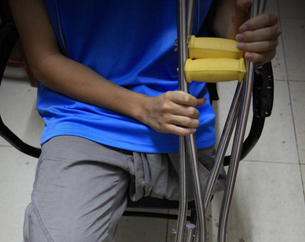 　　5岁那年，郭波过马路时不慎被车撞倒。送到医院，医生连连摇头说，伤太重，左腿必须截肢。还是懵懂儿童的他，根本不懂截肢意味着什么，“只看到父母一个劲地哭，哭得好伤心”。住院半年后出院，父母特意给他买了一副拐杖。“有一次出去玩，不小心绊倒在地，觉得拐杖是个累赘，就再也不用了。”“后来觉得跳着走路是一种锻炼身体的好方法。”郭波说，起初别人很担心他一只脚走路会有诸多不便，但“只要掌握好身体平衡就行，且跳行可锻炼我的意志，那是一种挑战”。