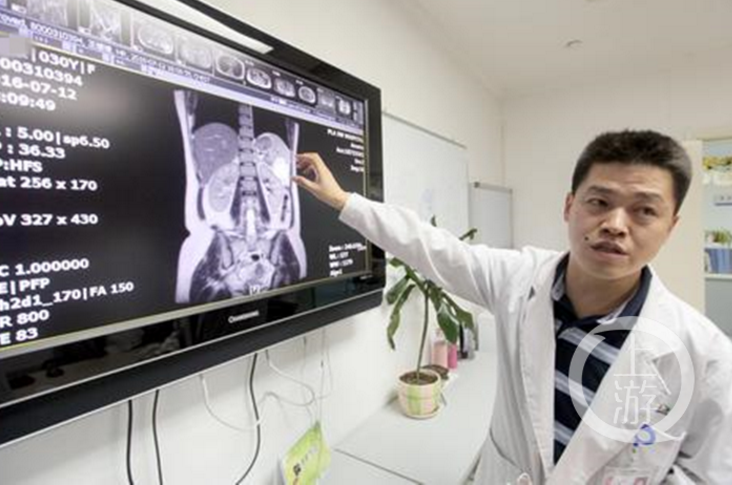 　　为找出原因，7月12日，王婷更换了一家医院进行检查，并增加了肝胆胰脾肾超声检查项目。正是在脾脏部位，一个活生生的胎儿被发现。当日下午，王婷在家人陪同下来到西南医院就诊，随即被妇产科紧急收治入院。该院妇产科梁志清教授和肝胆科郑树国等知名专家会诊后，建议先使用药物阻止胎儿过快生长，损伤王婷的脾脏，然后通过手术拿掉胎儿，并尽量保留一半脾脏及其功能。