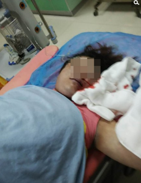 　　4日下午5点，有记者联系鼎城妇幼保健院，对方以事情还在处理中为由挂断了电话。下午7点半，苏先生说，已和鼎城妇幼保健院签了赔偿合约，赔偿金额为12万元。苏先生还表示，爱人尸体已被拉到殡仪馆，开始着手做尸检，将根据尸检结果，再进一步和医院商讨赔偿问题。