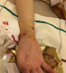 江苏小伙打死咬伤女友的狗被刑拘 还可能被批捕