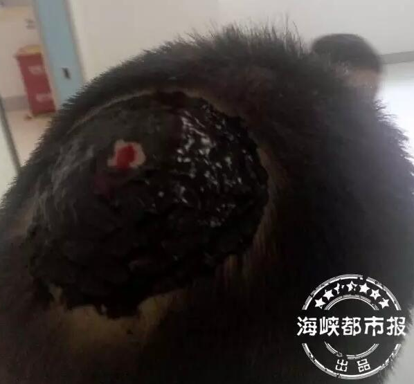 　　福州市鼓楼区园林局相关负责人告诉海都记者，修剪工作是23日上午开始的。“马蜂在树上筑窝很常见，但是马蜂窝一般都筑在避光隐蔽处，而且当时树叶密密麻麻的，很难发现马蜂窝，今天上午，我们有几名园林工人也被蜇伤了。”相关负责人说，马蜂蜇路人的情况，也是他们第一次遇到。图为被蜇的路人头皮留下一块血疤。
