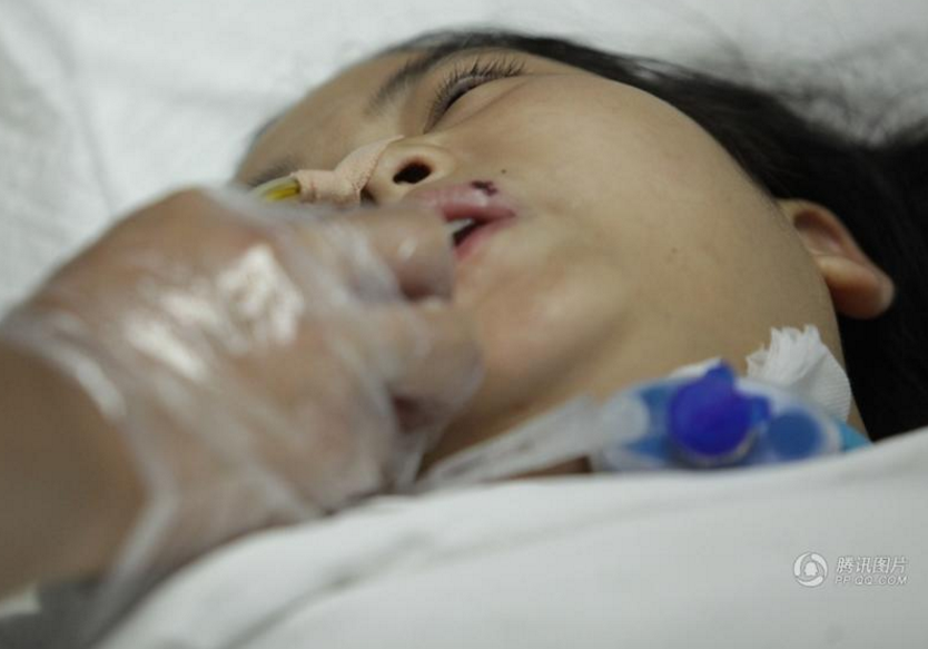 　　据马医生介绍，强气压的冲击，损伤了静阳的肺部、咽喉、食管，情况非常复杂，现在的生命体征虽然平稳，但恢复健康需要做的手术，难度太大。