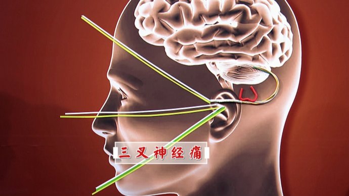 2016年8月29日播出《攻克“不死的癌症”》
