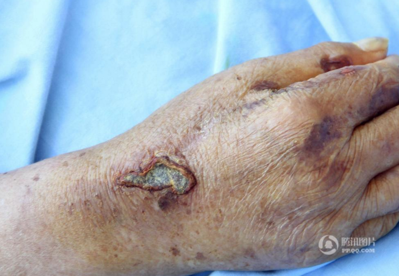 　　在范女士给记者提供的一段拍摄于其母亲于爱英清醒时的视频显示，画面中一名称呼于爱英姥姥的女孩问老人乳房是如何伤的时，老人说是烙铁烫的；问她是谁动手烫的时，老人说是其儿媳司某霞，并表示其儿子范某奎也在现场。需要指出的是，画面中显示老人在听到询问时嘴动了，但因为声音很低无法听清，画外音是这名女孩的。