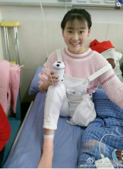 独腿患癌19岁女孩：请帮我捐眼角膜