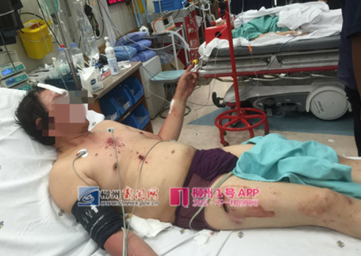 　　事情发生后，柳州市旅发委立即启动应急预案，通知领队报医抢救，立即将伤员送到附近医院，并报警和向中国驻南非大使馆联系，现已介入调查并做好救助。